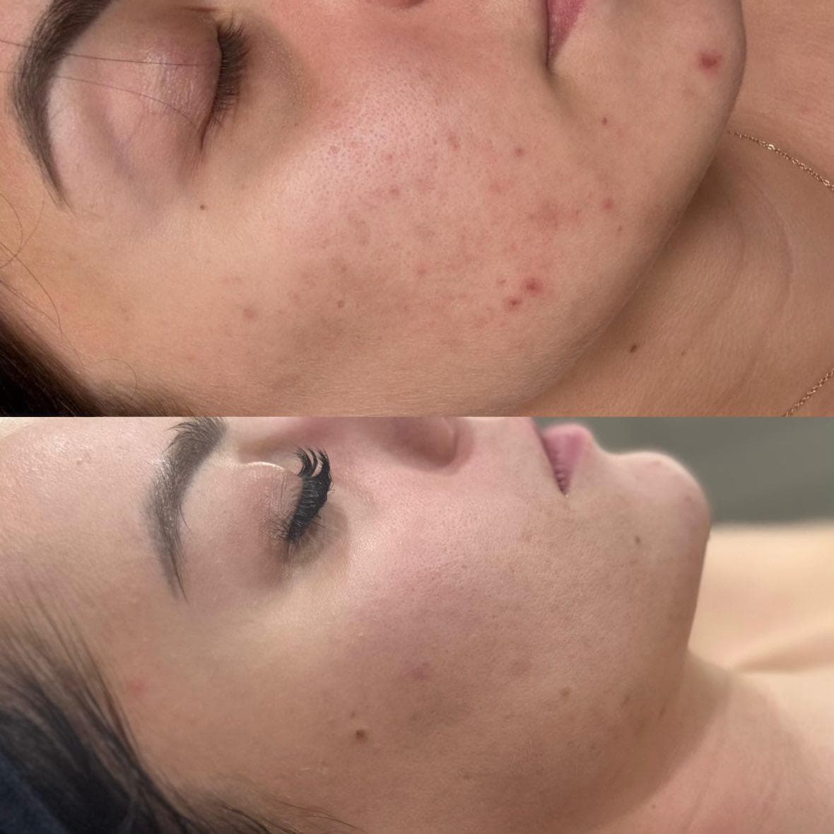 Zdjęcie metamorfozy 1