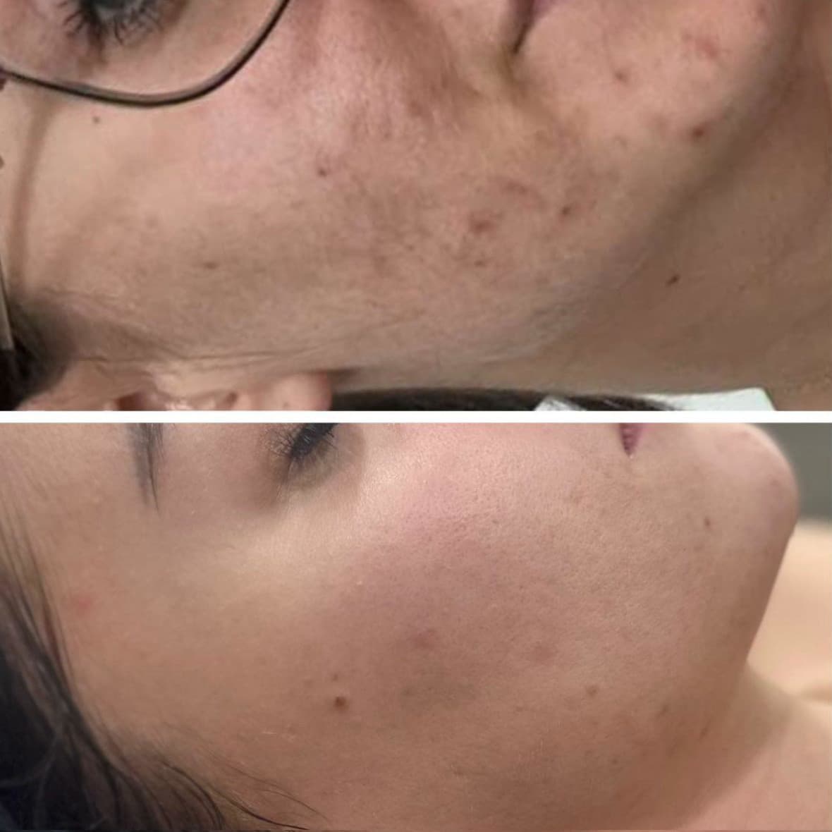 Zdjęcie metamorfozy 2