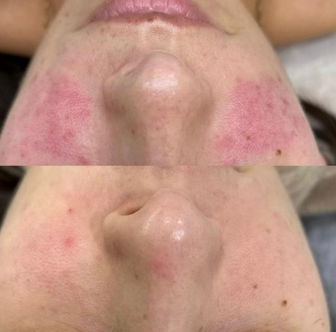 Zdjęcie metamorfozy 3