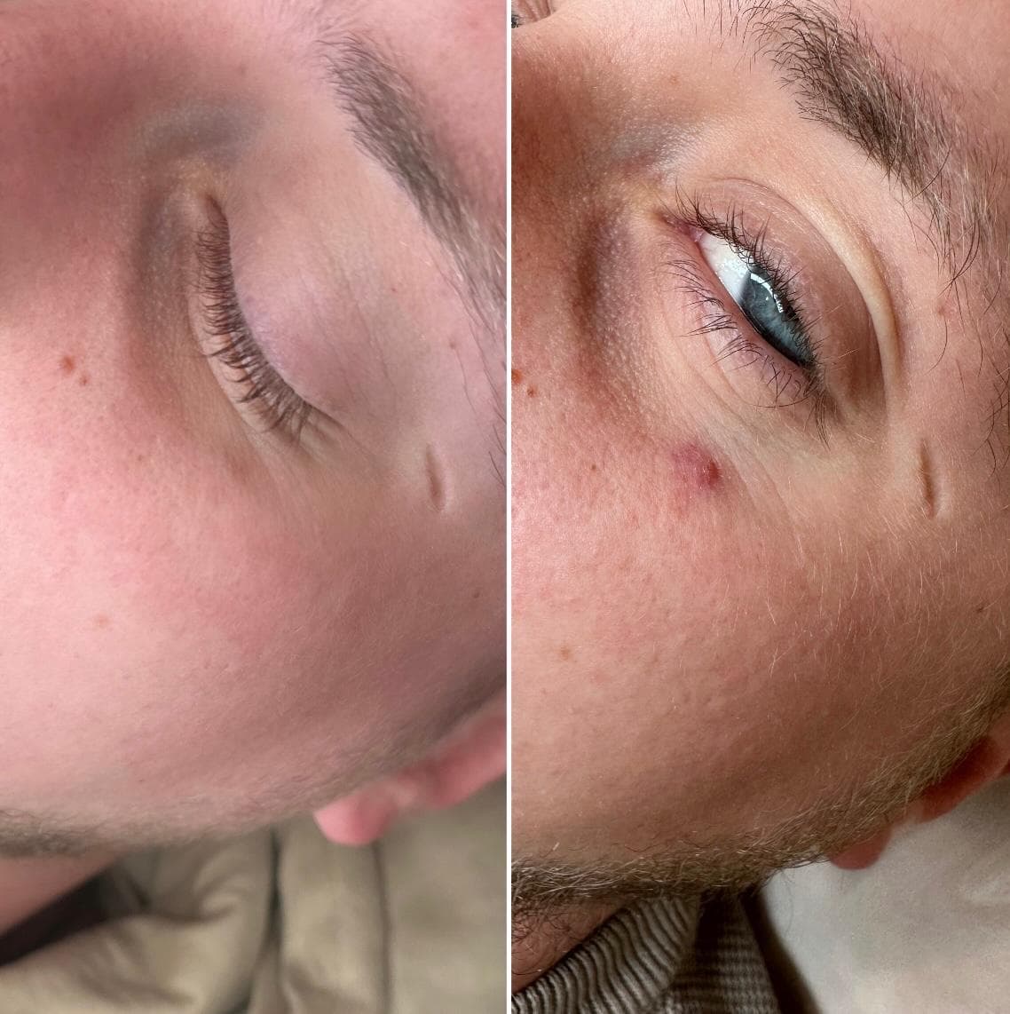 Zdjęcie metamorfozy 4